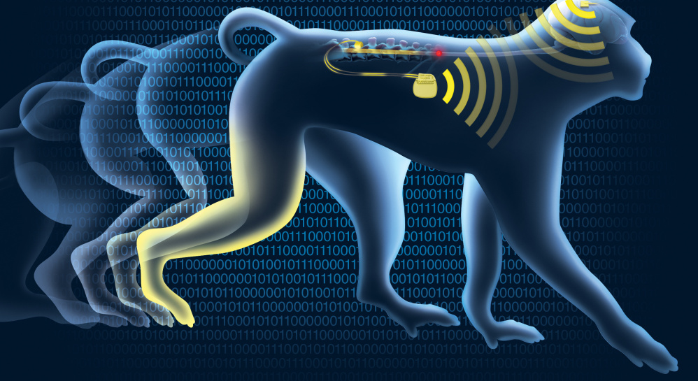 The use of a brain implant to wirelessly send signals to the legs' muscle groups could help people with spinal cord injuries regain some or all of their ability to move, even if the injury can't be repaired.