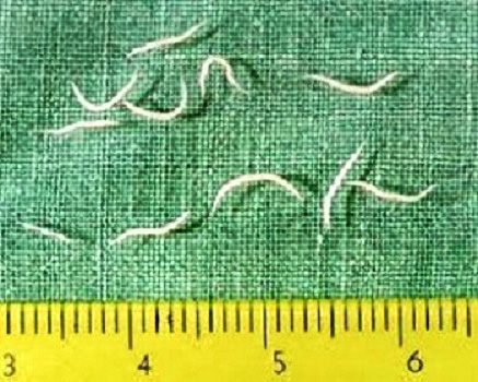 Pinworms